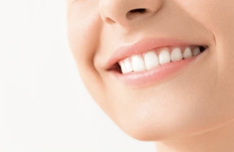 ホワイトニング