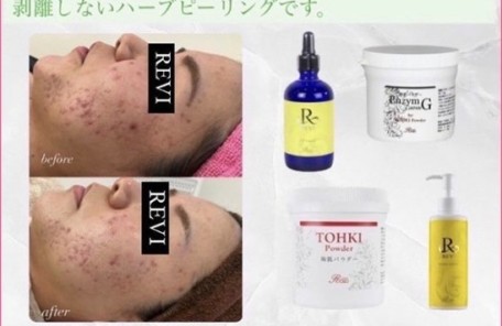 フェイシャル事例